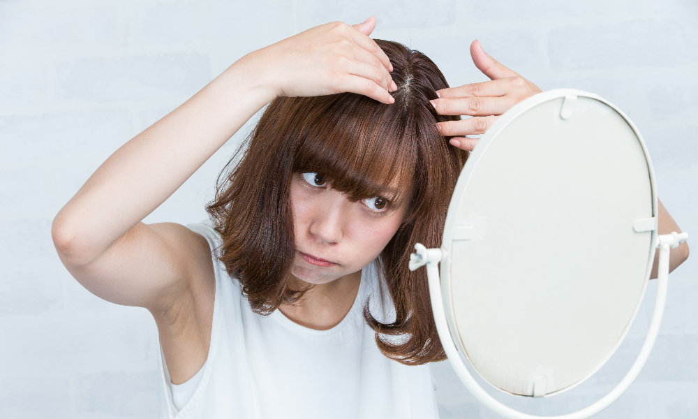 白髪染め　薄毛　女性