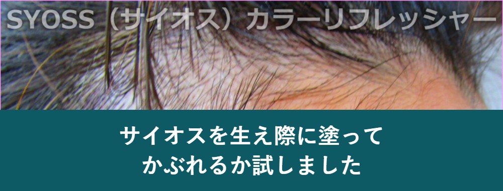サイオスを生え際に塗ってかぶれるか検証