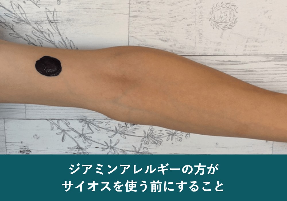 サイオスカラートリートメントとパッチテスト