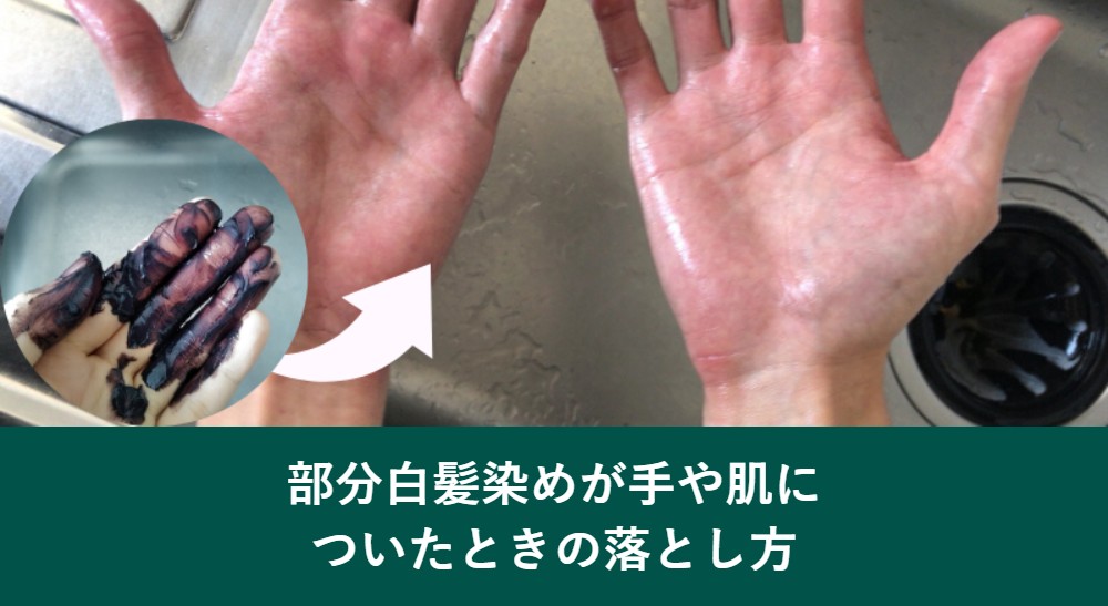 部分白髪染めが手や肌についたときの落とし方