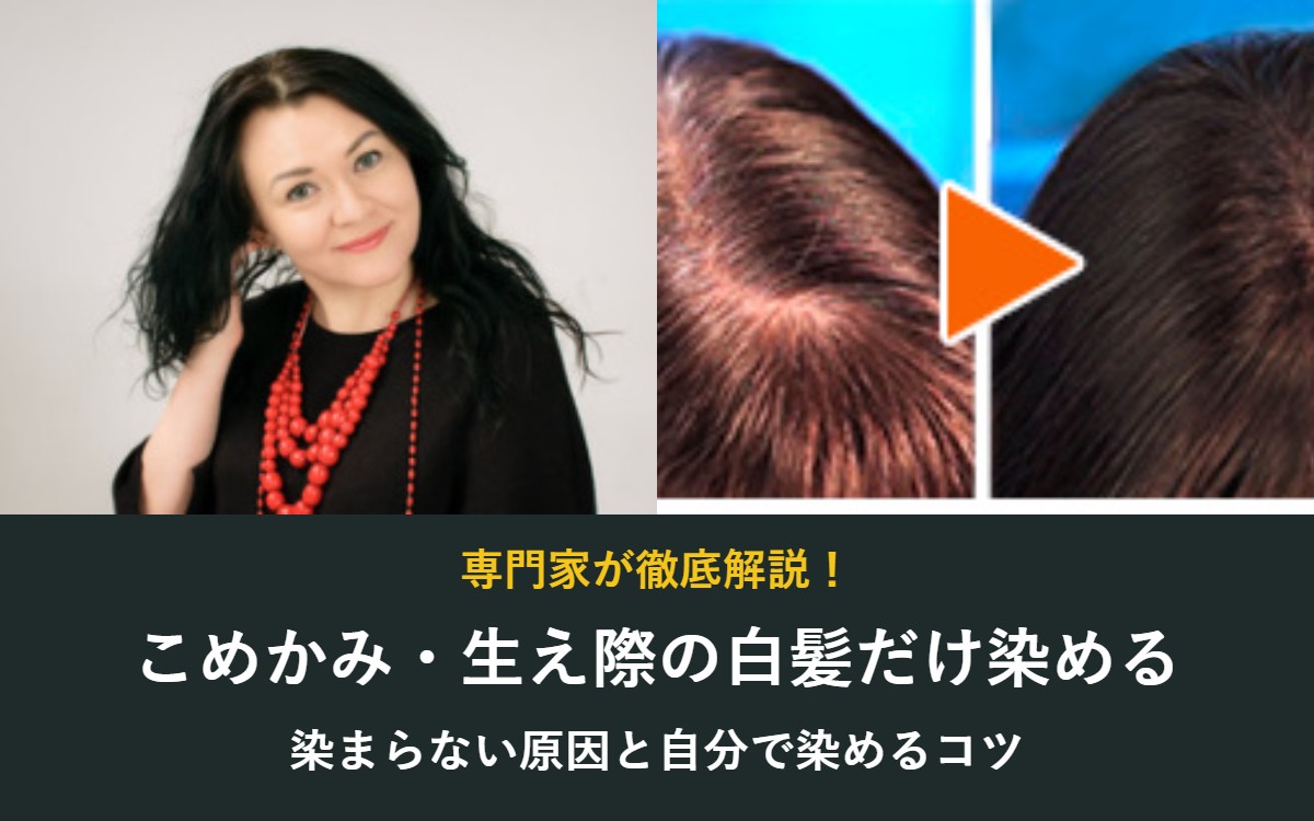 こめかみ・生え際の白髪だけ染める方法 染まらない原因と自分で染めるコツ