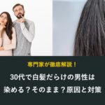 30代で白髪だらけの男性は染めるかそのままか、原因と対策