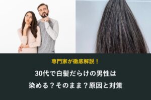 30代で白髪だらけの男性は染めるかそのままか、原因と対策