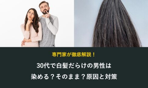 30代で白髪だらけの男性は染めるかそのままか、原因と対策