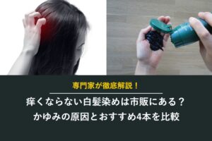 痒くならない白髪染めは市販にある？かゆみの原因とおすすめ4本を比較