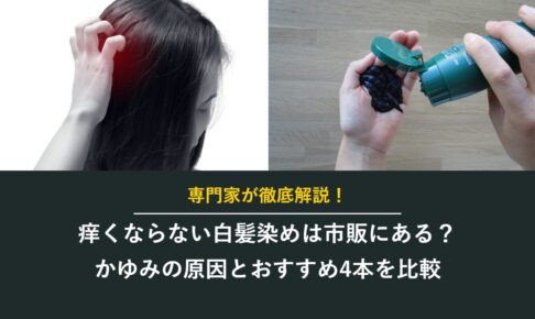 痒くならない白髪染めは市販にある？かゆみの原因とおすすめ4本を比較