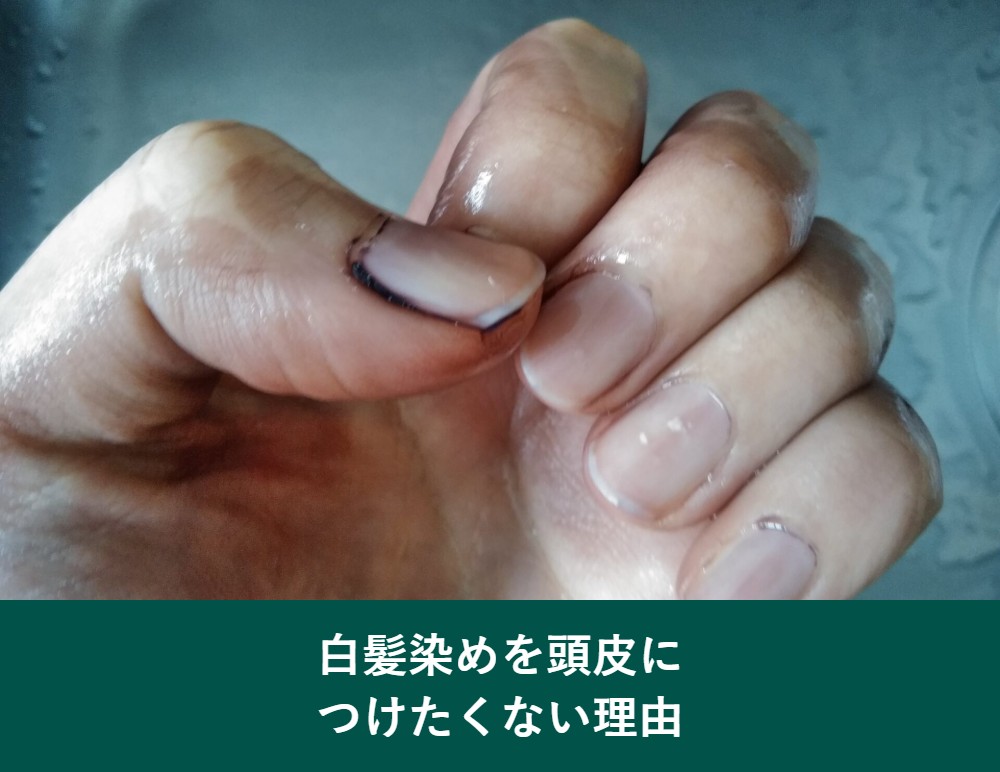 白髪染めを頭皮につけたくない理由