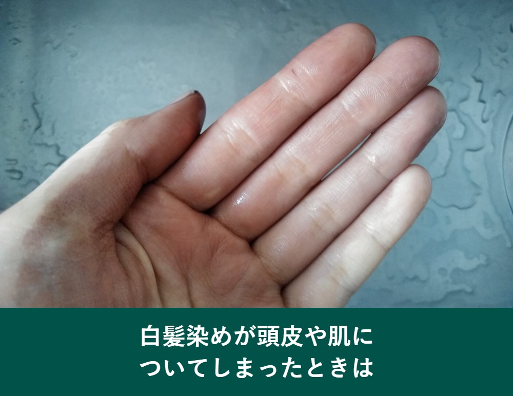 白髪染めが頭皮や肌についたときの対処